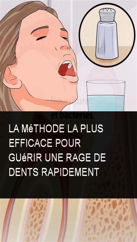 La méthode la plus efficace pour guérir une rage de dents rapidement