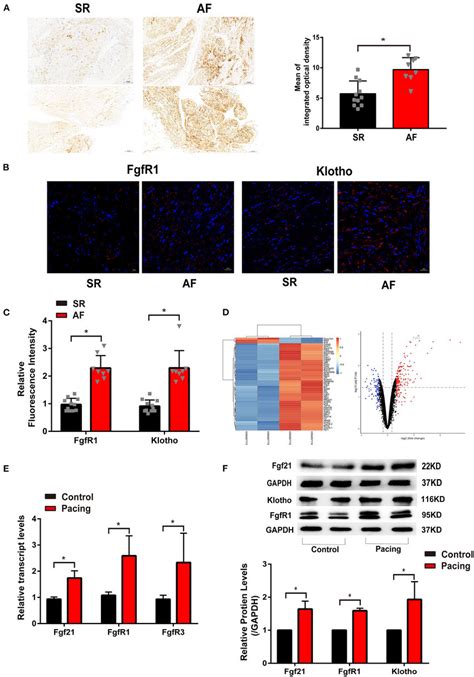 The Level Of Fibroblast Growth Factor 21 Fgf21 Increased In The Download Scientific Diagram