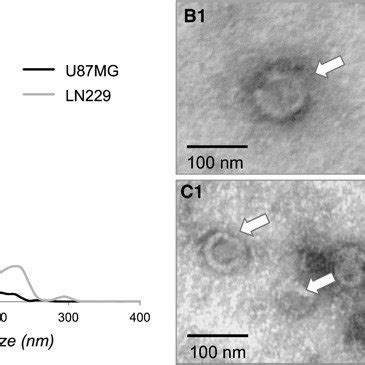 Characterization Of Gbm Derived Evs A Size Distribution Of U Mg And