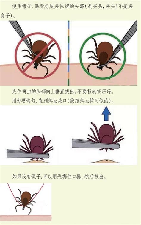 北京杀虫公司夺命蜱虫很可怕一张图教你蜱虫的正确死法 东方汉诺专业杀虫诚信品牌