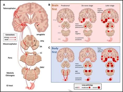 New Model May Explain The Mystery Of Asymmetry In Parkinsons Disease