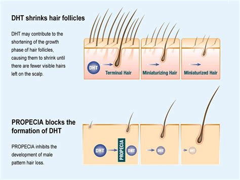 Hair Loss Solution Prescriptions — Advanced Hair Restoration