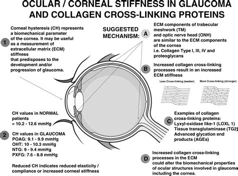 Corneal Stiffness And Collagen Cross Linking Proteins In Glaucoma