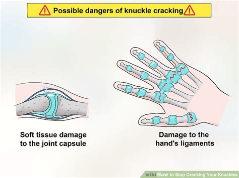 How to Stop Cracking Your Knuckles: 13 Steps (with Pictures)