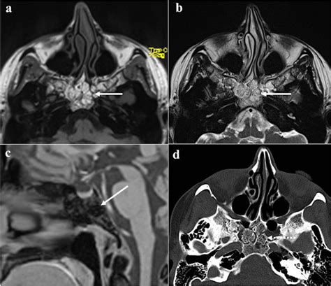 A Practical Overview Of Ct And Mri Features Of Developmental Inflammatory And Neoplastic