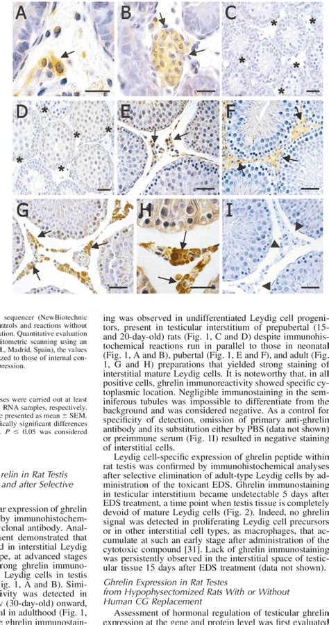 Sections Of Testicular Tissue Obtained From Rats At Different Age