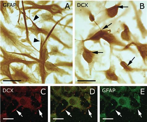 Cultured Astrocytes Derived From Human Glioblastoma Astrocytoma Cell