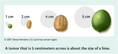 Tumor Size Centimeters Image Details Nci Visuals Online 57 Off