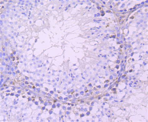 DAZL Rabbit MAb SAB Signalway Antibody