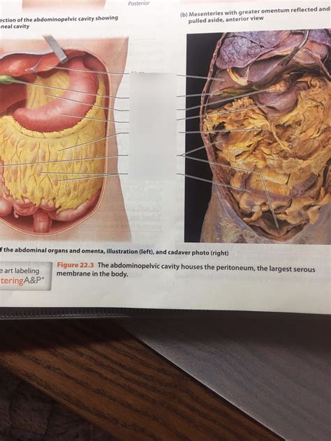 Anterior View Of Abdominal Organs And Omenta Diagram Quizlet