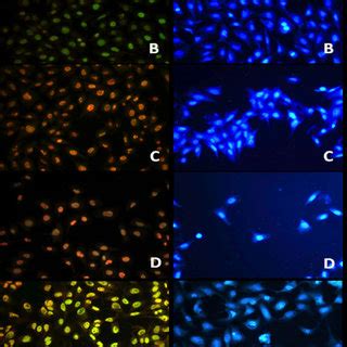 AO EB And Dapi Staining Of Control AL Pe And Dox Treated Hep3B Cell