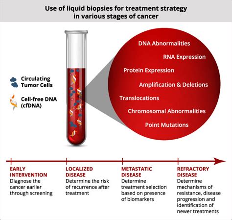 Blog — Liquid Biopsy A Non Invasive Procedure For Breast Cancer Detection