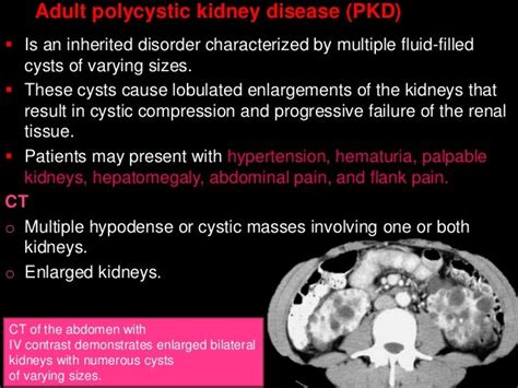 2 abdomen pathology ct