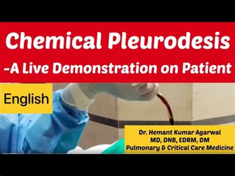 Chemical Pleurodesis A Live Demonstration On Patient English