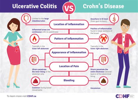 Ulcerative Colitis and Crohn's Disease: What's the Difference ...