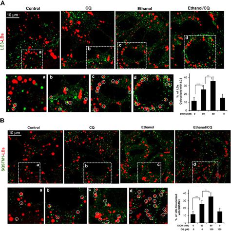 Both Lc3 And Sqstm1 Are Found On Lipid Droplets Aml12 Cells Were