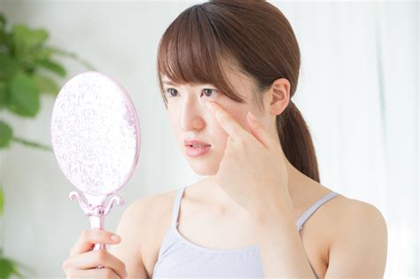 少しでも早く！ものもらいの治し方｜腫れを引かせるには？市販薬の選び方と病院に行く基準 Medicalookメディカルック