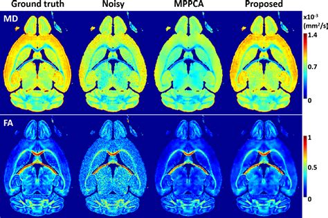 1 Center For Magnetic Resonance Research Radiology Medical School