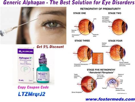 What Are Some Medications Used To Treat Glaucoma