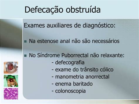 Ppt Patologia Perianal Powerpoint Presentation Free Download Id 829116