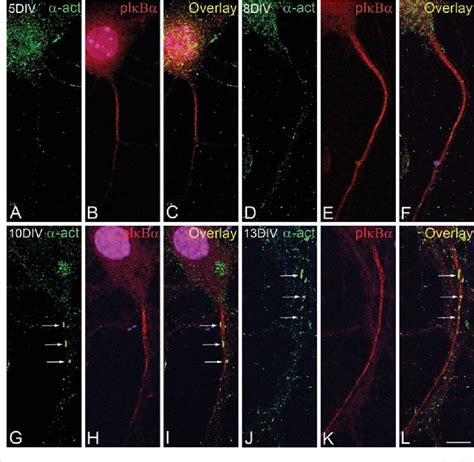 Figure From Colocalization Of Actinin And Synaptopodin In The