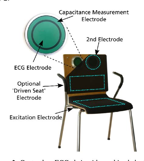 Figure From Signal Quality Assessment For Capacitive Ecg Monitoring