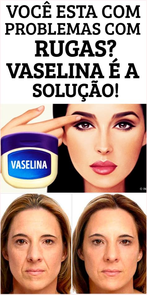 Receita Vaselina Para Eliminar Rugas No Rosto Passo A Passo