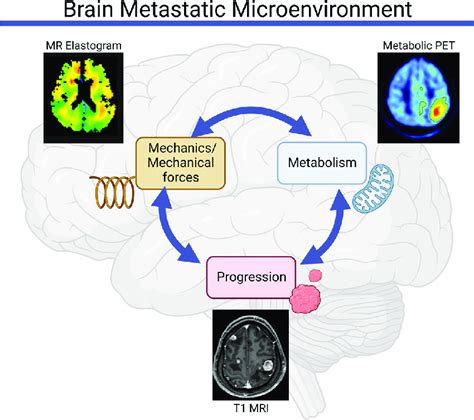 Mechanics And Metabolism Are Linked In The Brain Metastatic