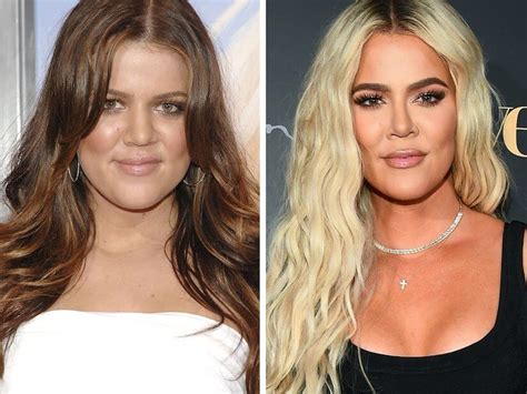 Khloé Kardashian Plastic Surgeries Milano Klinik