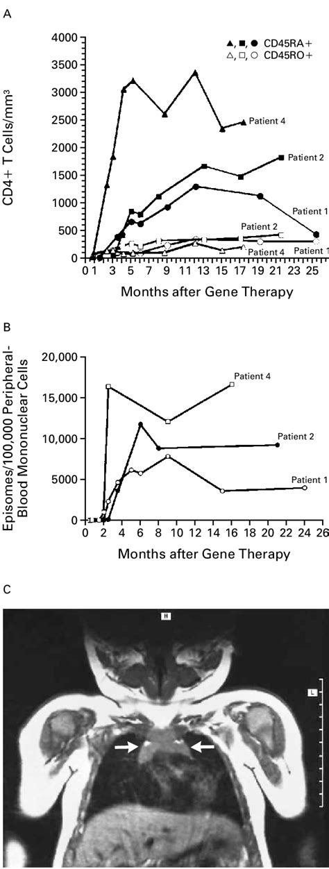 Numbers of Naive (CD45RA+) and Memory (CD45RO+) T Cells (Panel A) and ...