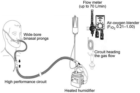 Humidified High Flow Nasal Oxygen During Respiratory Failure In The