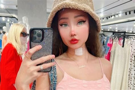 Lucinta Luna Pamer Wajah Usai Operasi Netizen Seperti Barbie Cantik