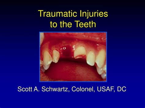 Traumatic Injuries