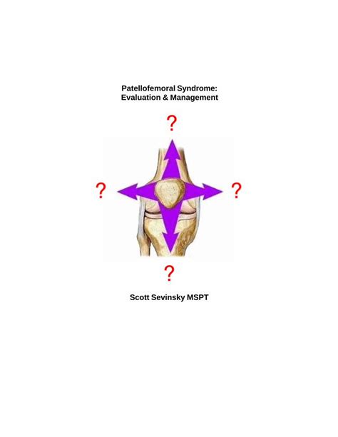 Pdf Patellofemoral Syndrome Evaluation And