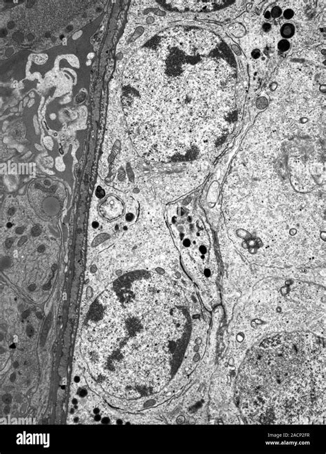 Spermatogonia Transmission Electron Micrograph Tem Of A Section