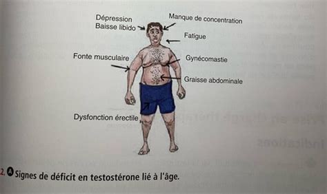 ITEM 124 Andropause syndrome de déficit en testostérone lié à l âge