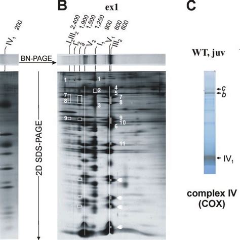 Distinct Supercomplexes In Mitochondria Of P Anserina Wild Type Strain Download Scientific