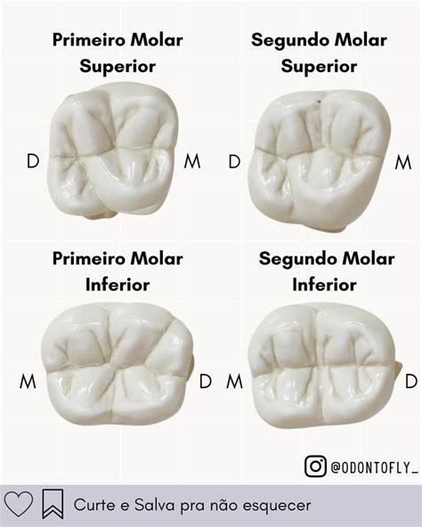 Anatomia Do Segundo Molar Superior Aula De Anatomia Dental Dente My