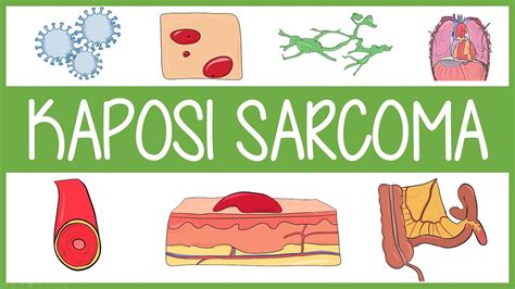 Kaposi Sarcoma In 3 Minutes Youtube