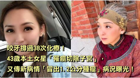 咬牙撐過38次化療！43歲本土女星「罹癌切除子宮」，又傳新病情「冒出1 2公分腫瘤」病況曝光！ Youtube