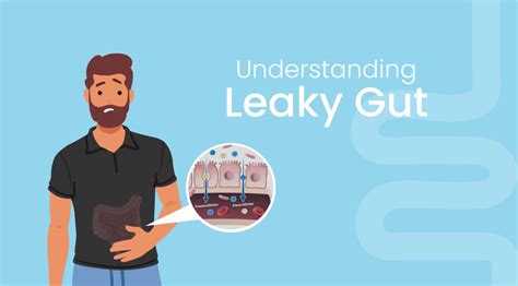 Leaky Gut Syndrome What It Is Symptoms And Treatments