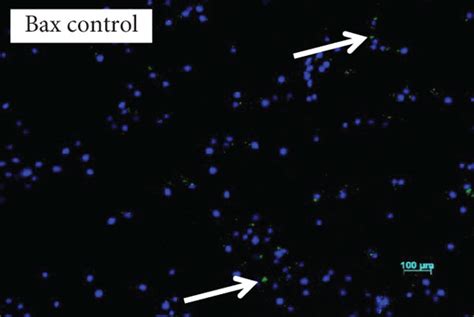 Immunofluorescence Caspase P And Bax A Control Cells Showing