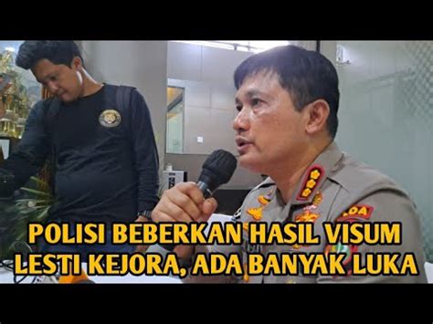 Polisi Beberkan Hasil Visum Lesti Kejora Ada Banyak Luka Youtube