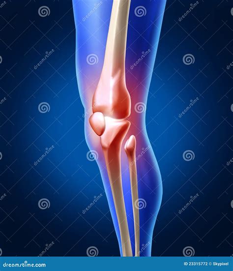 Human Knee Pain stock illustration. Illustration of joints - 23315772