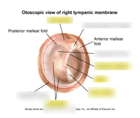 Tympanic Membrane Diagram Diagram | Quizlet