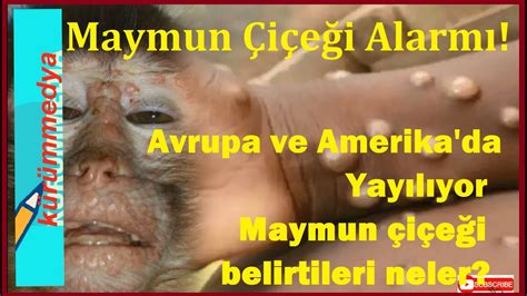 Maymun Çiçeği Virüsü Alarmı Maymun Çiçeği Virüsü nedir Maymun Çiçeği