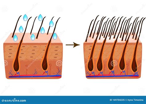 Tratamiento De La Alopecia Cabello De Vitaminas Biotina Trastornos De