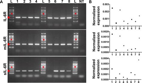 Il 6r Transcript Expression In Human Retinal Endothelial Cells A