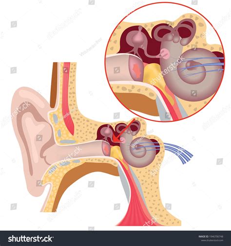 Inner Ear Anatomy Damage Tympanic Membrane Stok Vektör Telifsiz 1946706748 Shutterstock