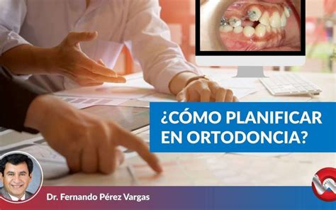 Como Planificar En Ortodoncia Odonto Science